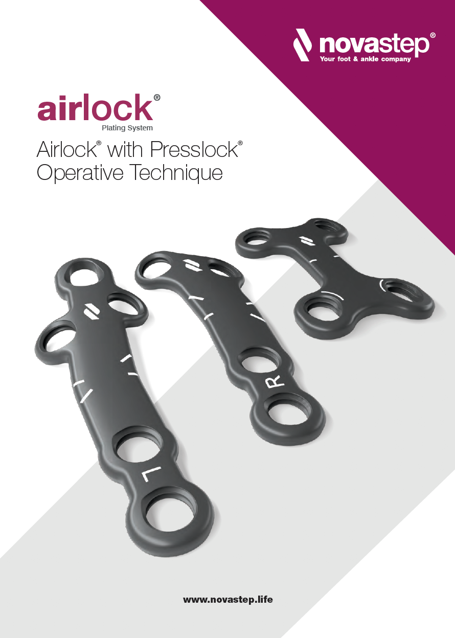 airlock-with-presslock
