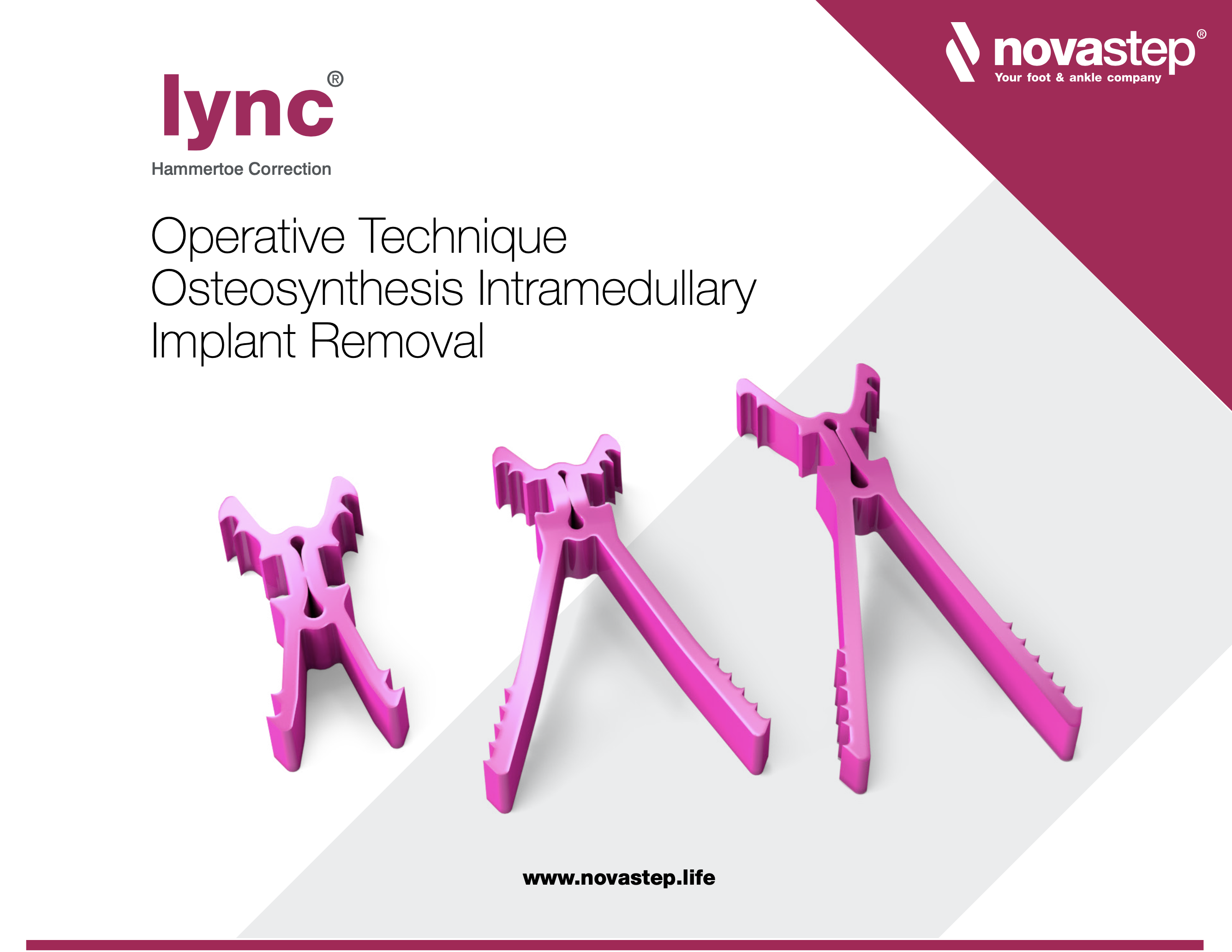 Lync Implant Removal Operative Technique
